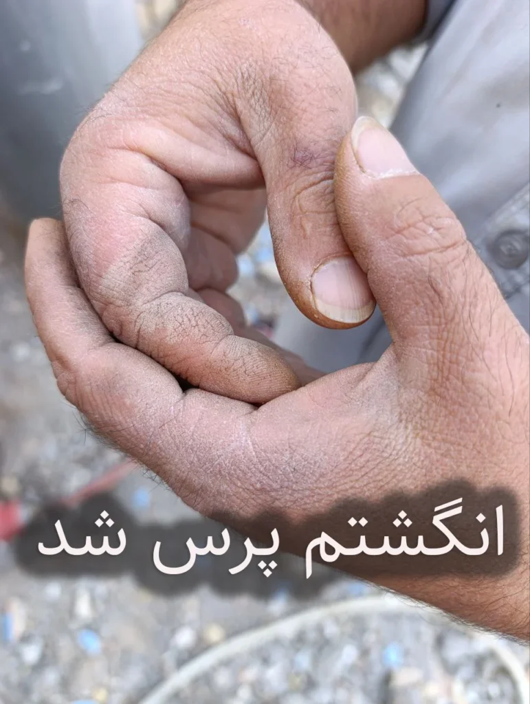 انگشتم پرس شد